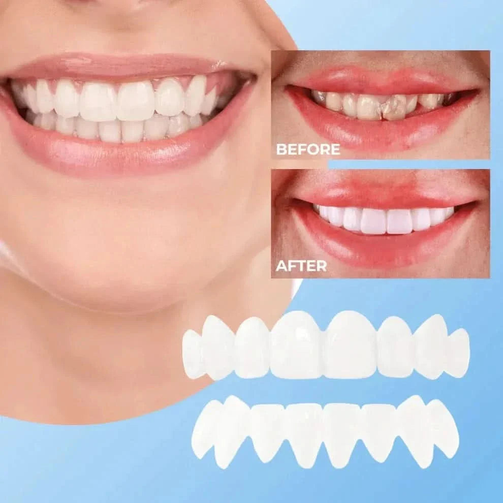Lonryd SmileFlex™