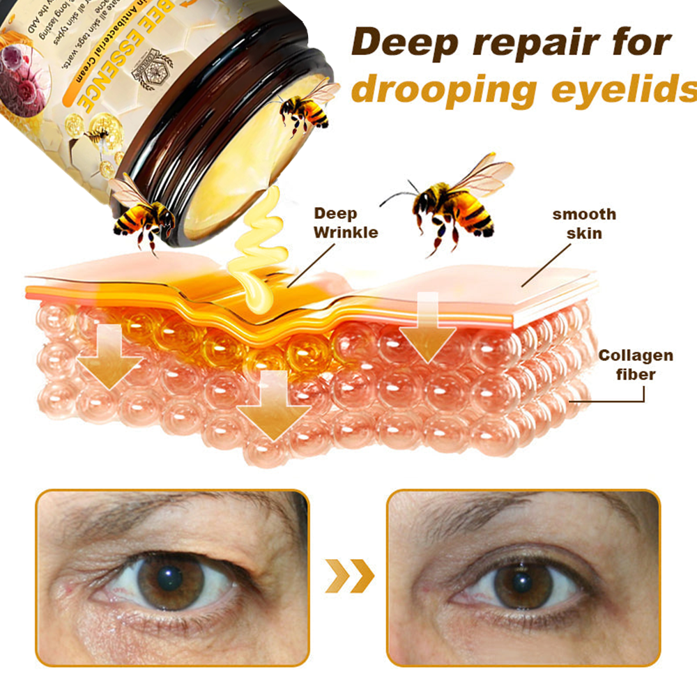 Bee Essence Skin Antibacterial Cream—used to treat a variety of skin diseases (AAD recommended)