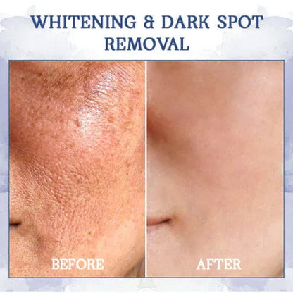 ✨🩵𝐋𝐚𝐬𝐭 𝐃𝐚𝐲 𝐃𝐢𝐬𝐜𝐨𝐮𝐧𝐭: 87% 𝐎𝐅𝐅🌸LOVILDS® 𝐀𝐝𝐯𝐚𝐧𝐜𝐞𝐝 𝐅𝐢𝐫𝐦𝐢𝐧𝐠 & 𝐖𝐫𝐢𝐧𝐤𝐥𝐞-𝐑𝐞𝐝𝐮𝐜𝐢𝐧𝐠 𝐂𝐫𝐞𝐚𝐦: Restore Skin Elasticity⭐